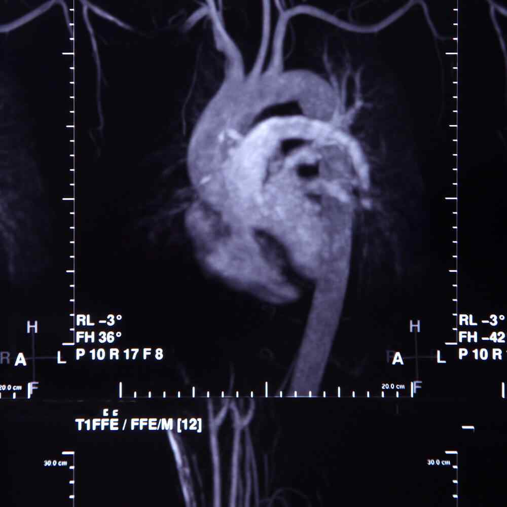 https://drsamdany.com/wp-content/uploads/2021/08/inner_image_05.jpg